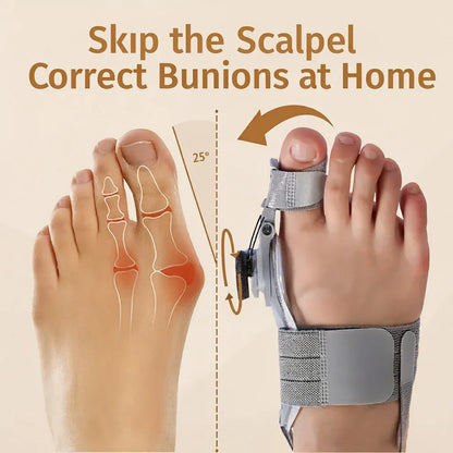 StepEase™ | Orthopedic Toe Straightener